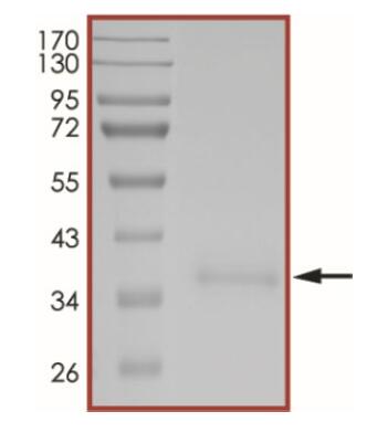 The purity of 2019-nCoV Spike protein S1 subunit, RBD (N440K) was determined to be >90% by densitometry